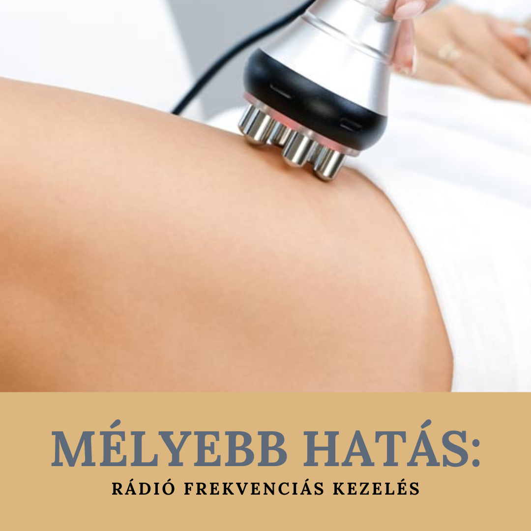 Mitől hatékony a Rádió Frekvenciás kezelés?